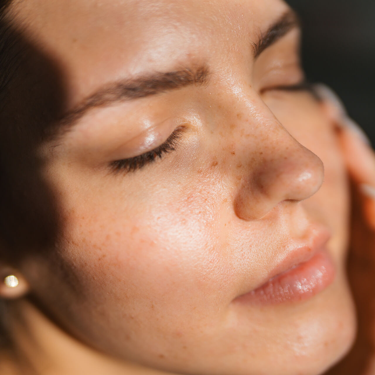 Lifting facial sin cirugía