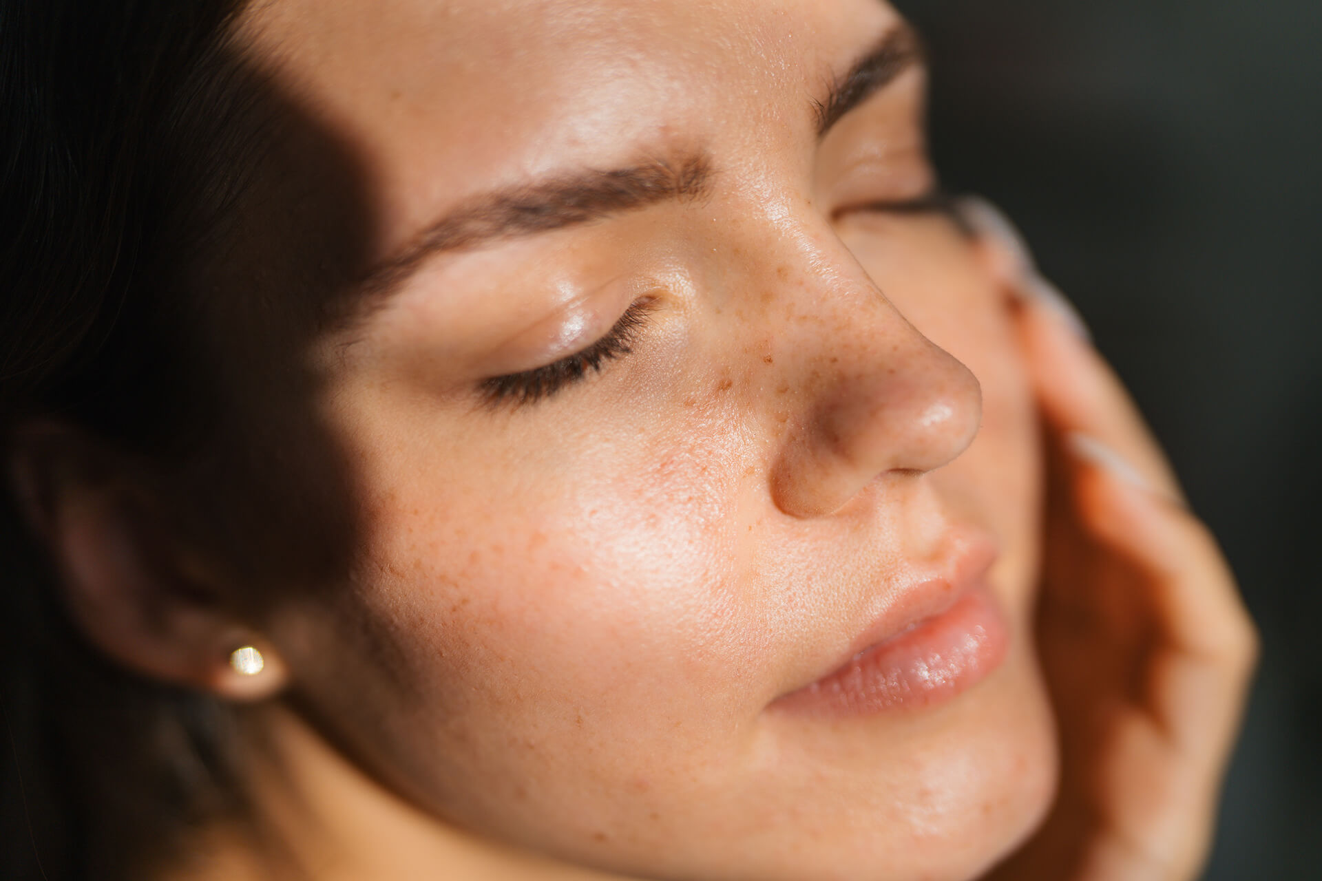 Lifting facial sin cirugía